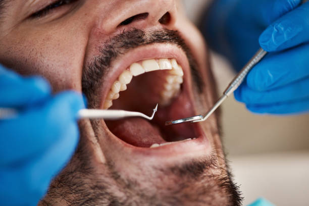 Best Emergency Broken Tooth Repair in Oak Grove, AL