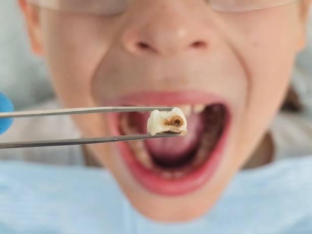 Best Emergency Broken Tooth Repair in Oak Grove, AL